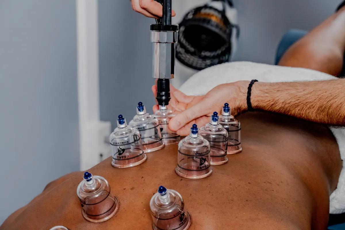 Close-up of cupping therapy being applied to a client's back with multiple glass cups positioned on the skin.