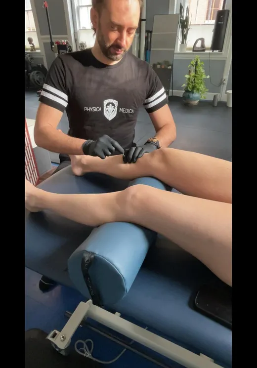 Practitioner using myofascial cupping tool on client's leg while client lies on treatment table