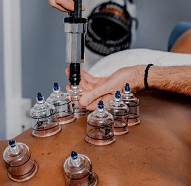Baltimore-Physical-Therapist-cupping.png