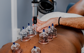 Baltimore-Physical-Therapist-myofascial-cupping.jpg